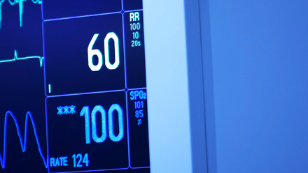 A hospital monitor screen