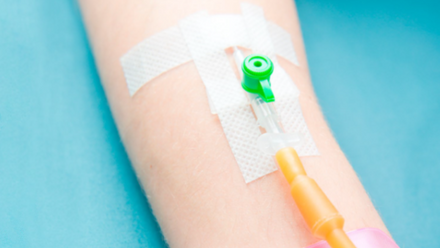 A green and orange cannula in a patient's arm
